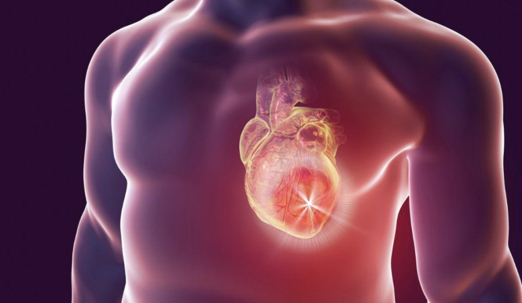 Rheumatic Heart Disease